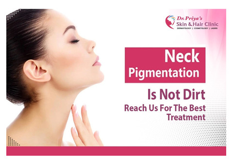 Reclaim Your Glow: Best Pigmentation Treatments in Bangalore Revealed
