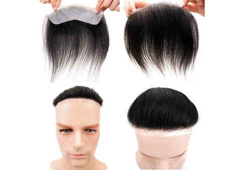 Affordable Hair Patch in Delhi