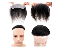 Affordable Hair Patch in Delhi