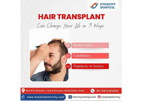 Hair Transplant Treatment Near Indirapuram