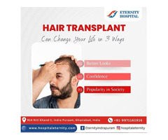 Hair Transplant Treatment Near Indirapuram