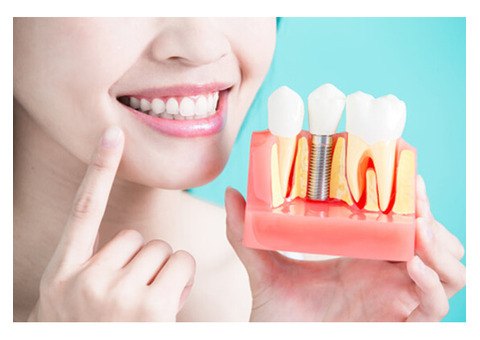Enhancing Smiles with Dental Crowns in Lithia