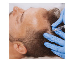 Before and After PRP Hair Treatment