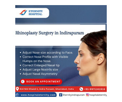 Rhinoplasty Surgery in Indirapuram