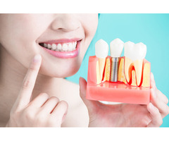 Transform Your Smile at Bridge Family Dental