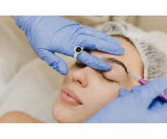 Scar Reduction: Effective Microneedling Treatment