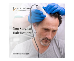 non surgical hair restoration