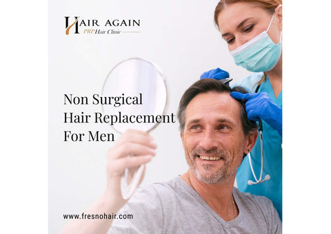 best non surgical hair replacement