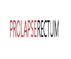 Rectal Prolapse Treatment