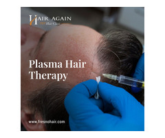 PRP Hair Therapy in Fresno