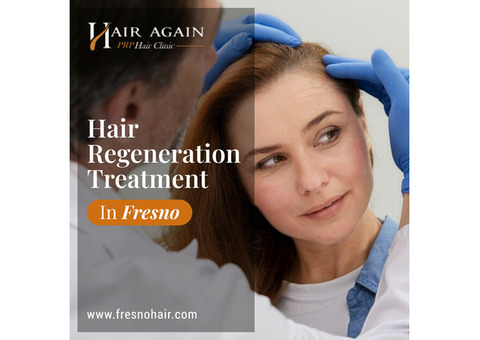 Hair Regeneration Treatment in Fresno CA