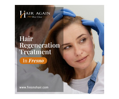 Hair Regeneration Treatment in Fresno CA