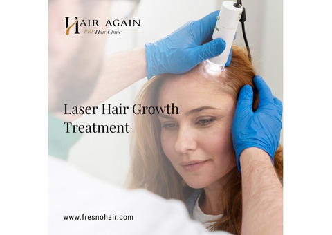laser hair growth treatment Fresno