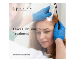 laser hair growth treatment Fresno