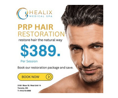 PRP Hair Restoration for Men in Toronto, ON