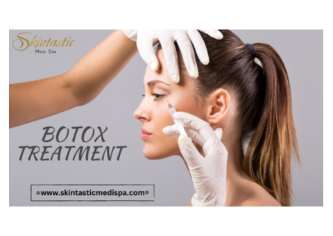 Wrinkle and Fine Lines Free Botox in Riverside