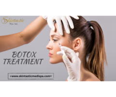 Wrinkle and Fine Lines Free Botox in Riverside