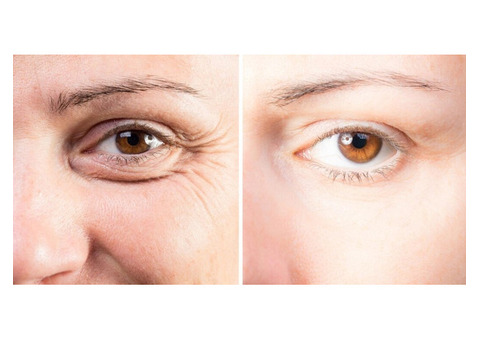 Enhance Your Look with Top Eyelid Surgeon Dr. John Martin