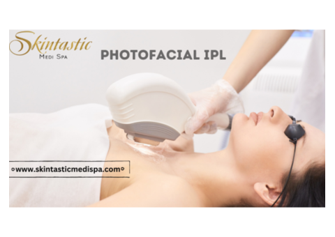 Radiant Skin with Photofacial IPL in Riverside