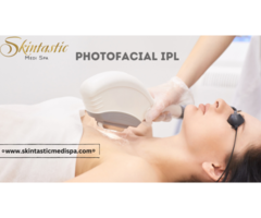 Radiant Skin with Photofacial IPL in Riverside