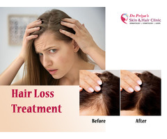 Best Hair Loss Treatment Clinics in Bangalore: Get Results Now!