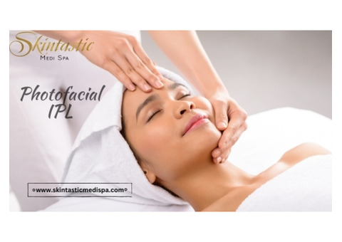Experience Radiant Skin with Photofacial IPL in Riverside