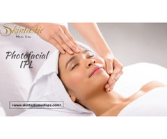 Experience Radiant Skin with Photofacial IPL in Riverside