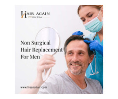 best non surgical hair replacement