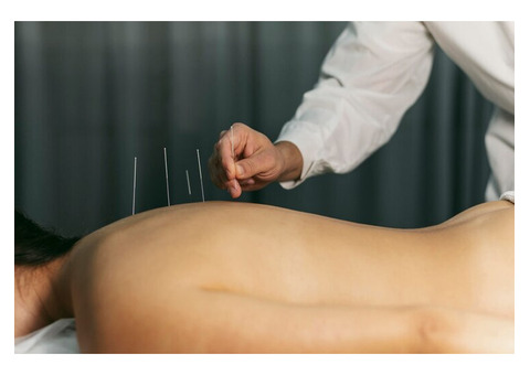 Acupuncture Improve Indigestion Abdominal Distention