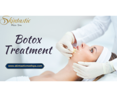 Personalized Botox in Riverside