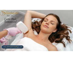 Laser Hair Removal in Riverside with Advanced Technology