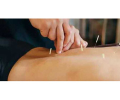 Effective Dry Needling Therapy Texas for Pain Relief