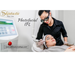 Best Photofacial IPL Treatment in Riverside