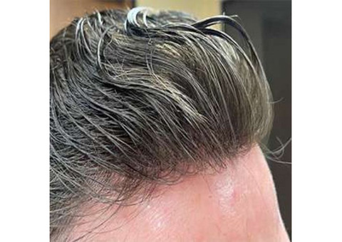 Toupees for Men in Yorba Linda