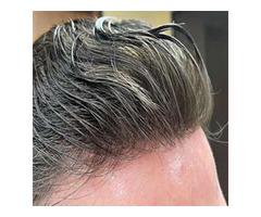 Toupees for Men in Yorba Linda