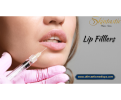 High Quality Lip Fillers Near Me