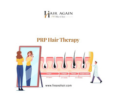 Platelet Rich Plasma Hair Therapy