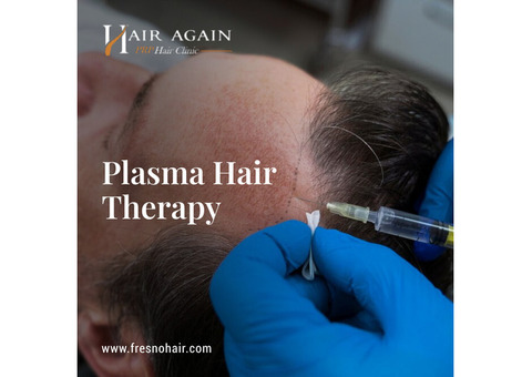 Platelet Rich Plasma Hair Therapy
