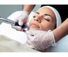 Mesotherapy Facial Treatment