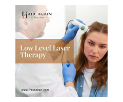 laser hair therapy Fresno