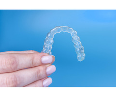 Top Benefits of Clear Aligners