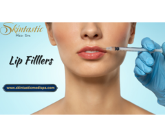 Lip Fillers in Riverside for Smooth Lips