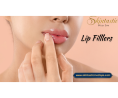 Top-Quality Lip Fillers in Riverside for Perfect Lips