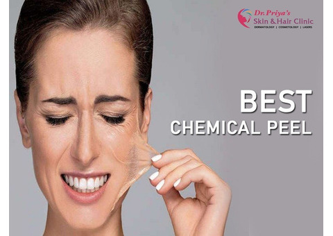 Discover Radiant Skin with Best Chemical Peel Treatments in Bangalore