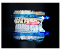 The Role of CAD CAM in Dental Implants