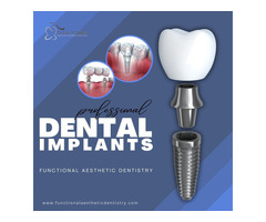 Dental implants Summerlin