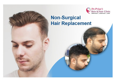 Discover the Best Non-Surgical Hair Replacement Solutions