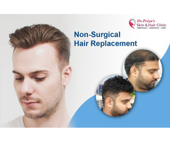 Discover the Best Non-Surgical Hair Replacement Solutions