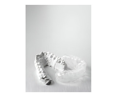 The Role of Modern Technology in Dental Aligners in USA