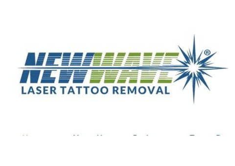 New Wave Laser Tattoo Removal | Tattoo Fading Bethlehem PA